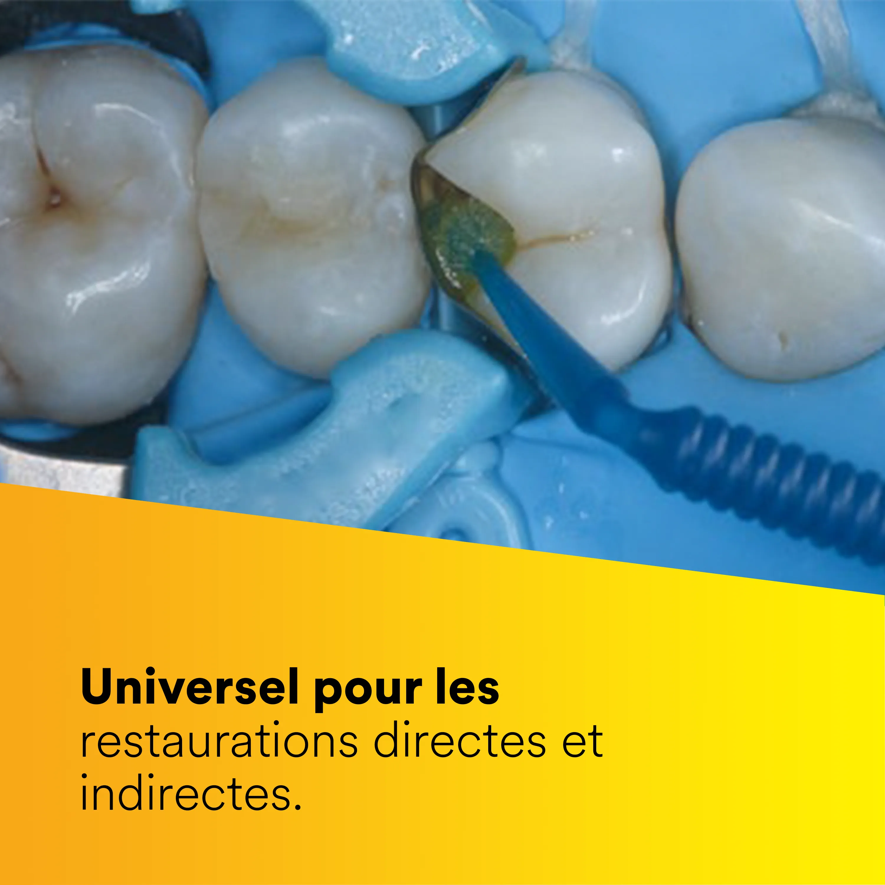 3M™ Scotchbond™ Universal Plus Adhésif, 400 L-Pop