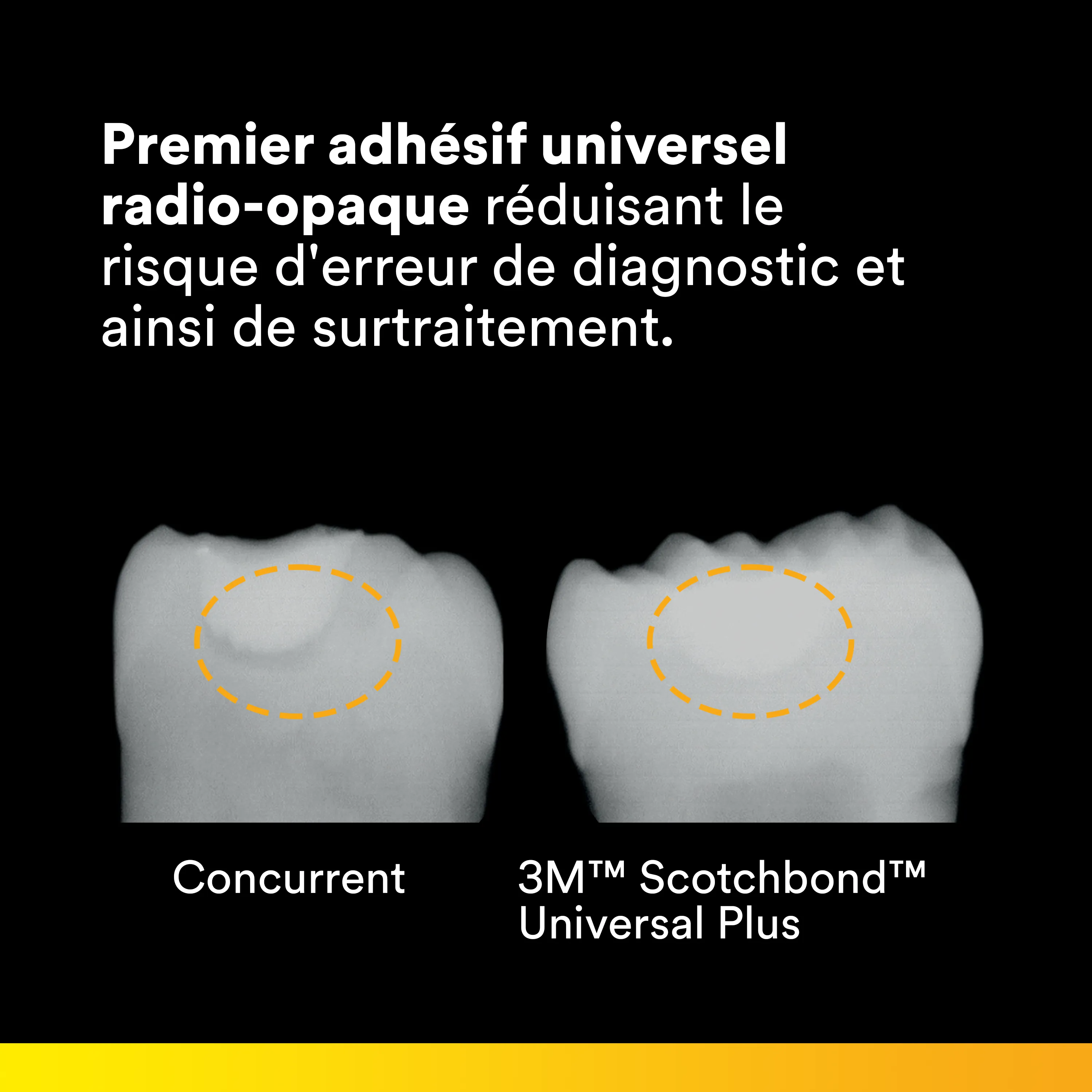 3M™ Scotchbond™ Universal Plus Adhésif, 400 L-Pop