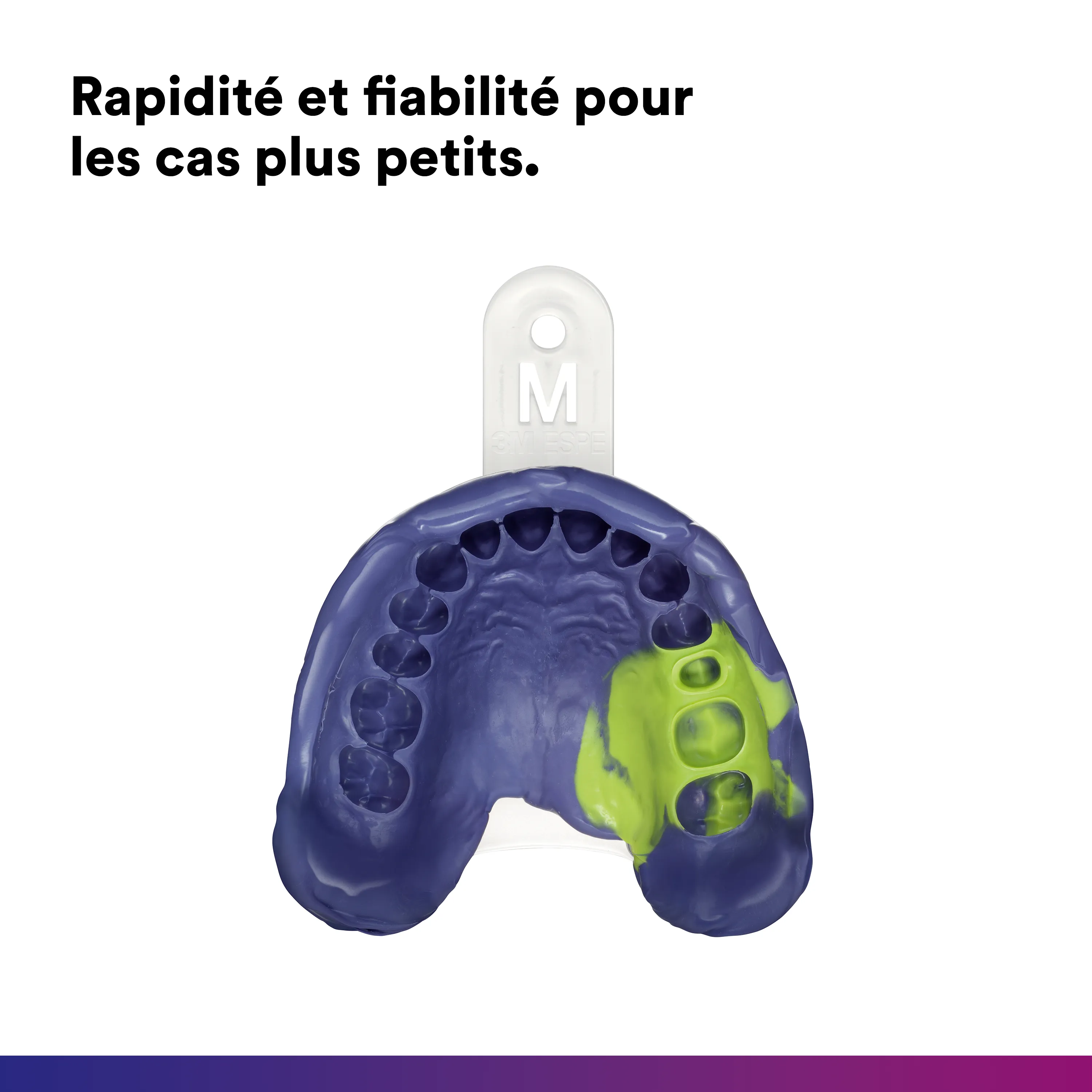 3M™ Impregum™ Super Quick Matériau d’empreintes Polyéther, Medium Body/Light Body, starter pack